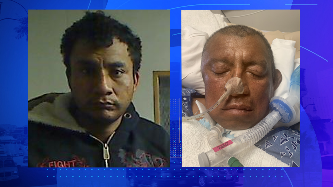 Hospital de Los Ángeles necesita ayuda para identificar a 2 pacientes