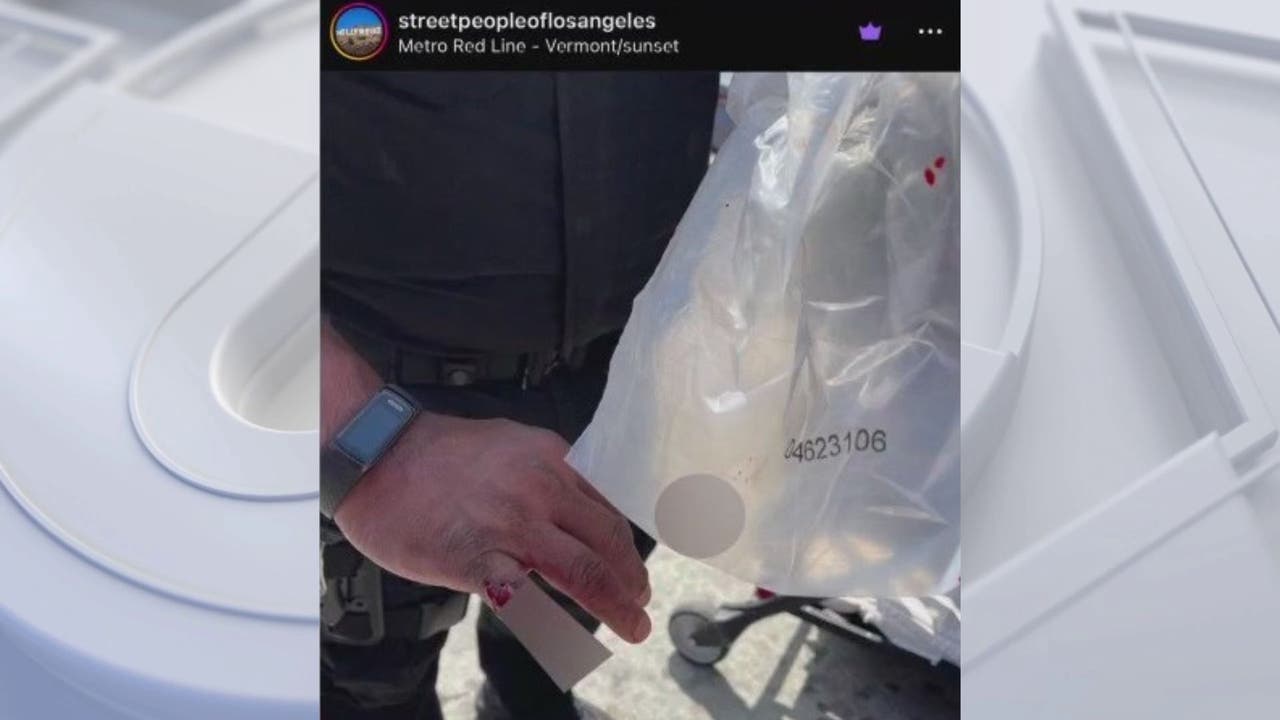 Supuestamente, una persona sin hogar le muerde el dedo a un oficial de policía de Los Ángeles en Santa Monica Blvd.